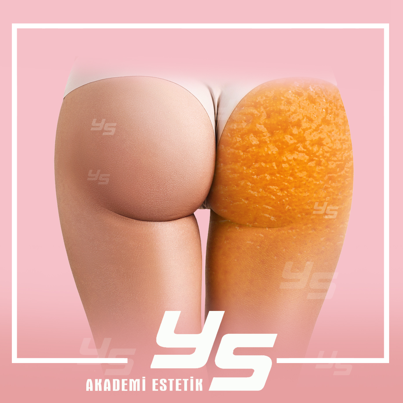 YS AKADEMİ ESTETİK